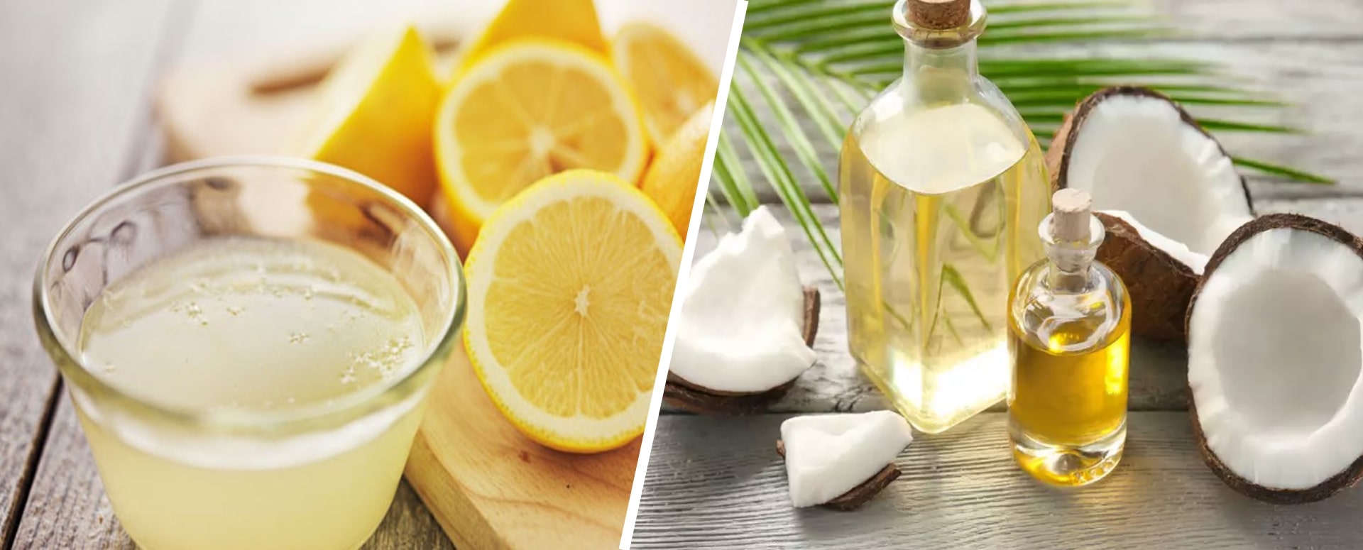 பொடுகை போக்க உதவும் ஒரு எளிய வீட்டு வைத்தியம்